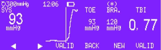 SYSTOE: display of toe pressure and TBI (Toe Brachial Index)