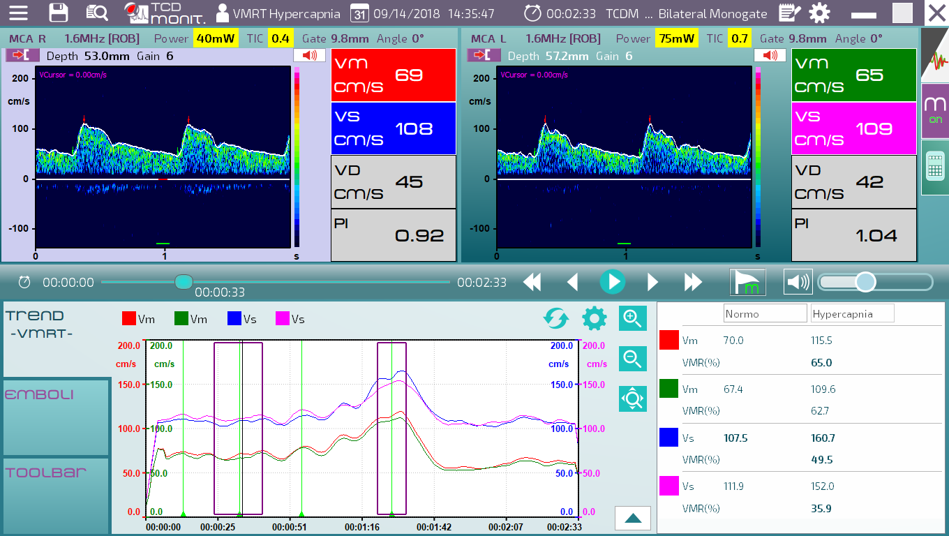 Simultaneous monitoring of blood velocity in MCA and cardiac output