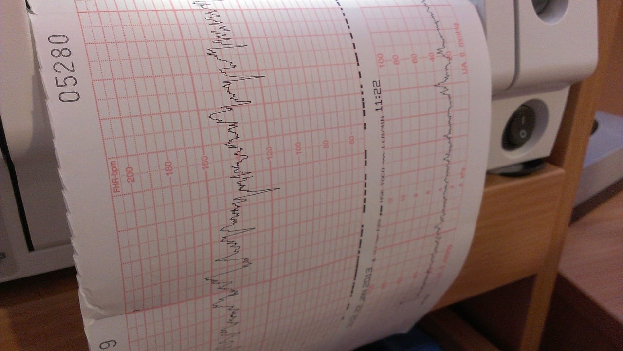 echographie