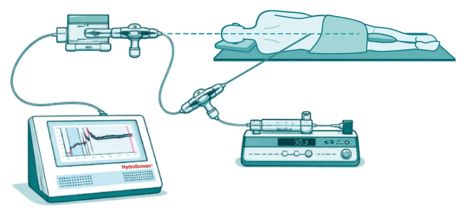 Set-up: HydroScreen connected to a pressure transducer and a syringe pump, patient lying down