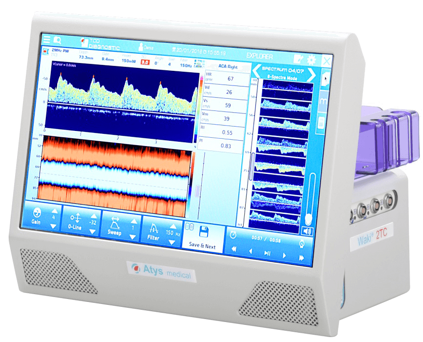 Atys medical wakie-Doppler transcranien