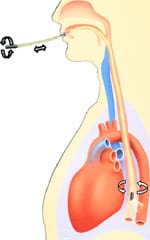 insertion of the oesophageal Doppler probe in oesophagus